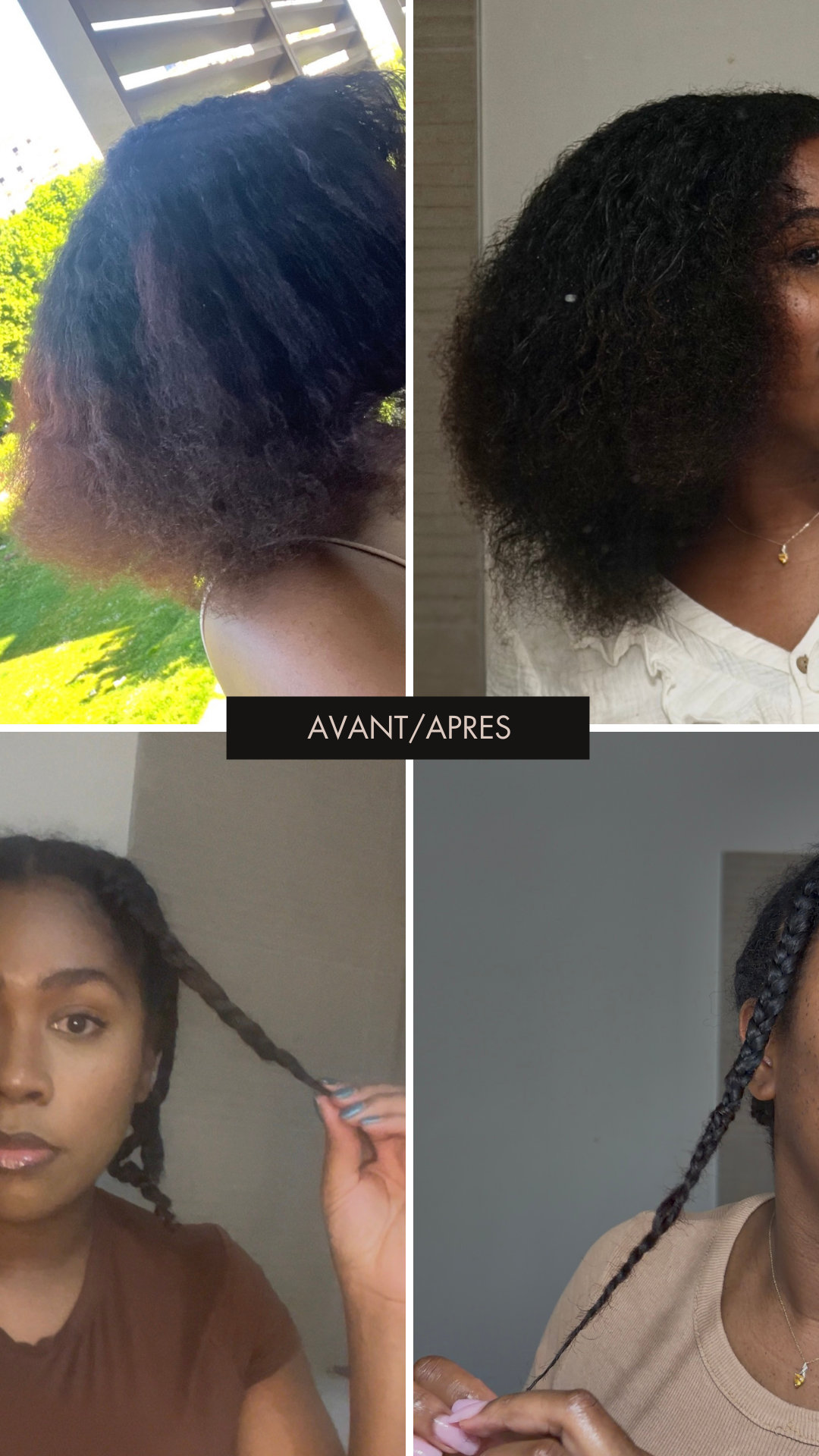 Stimulateur de Follicules à Lumière Rouge — Massage Cuir Chevelu pour Pousse & Rétention | Cheveux Crépus | Oëyya
