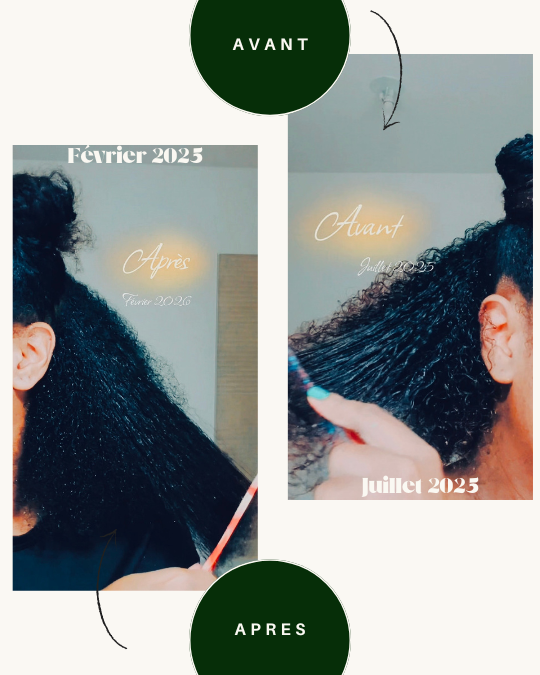 Masseur Cuir Chevelu Lumière Rouge - Stimulateur Pousse Cheveux Oëyya