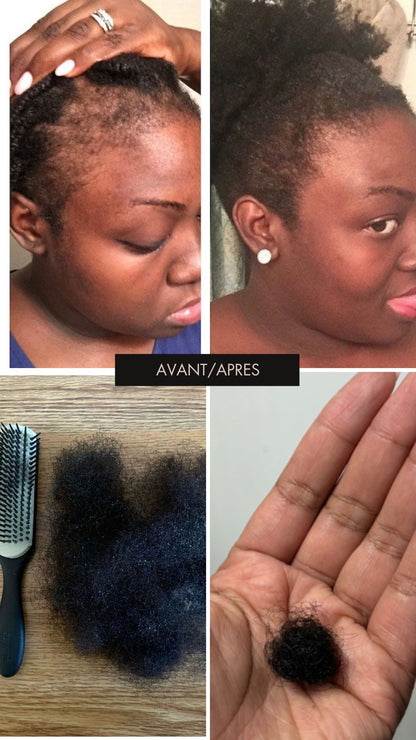 Stimulateur de Follicules à Lumière Rouge — Massage Cuir Chevelu pour Pousse & Rétention | Cheveux Crépus | Oëyya