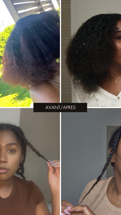 Stimulateur de Follicules à Lumière Rouge — Massage Cuir Chevelu pour Pousse & Rétention | Cheveux Crépus | Oëyya