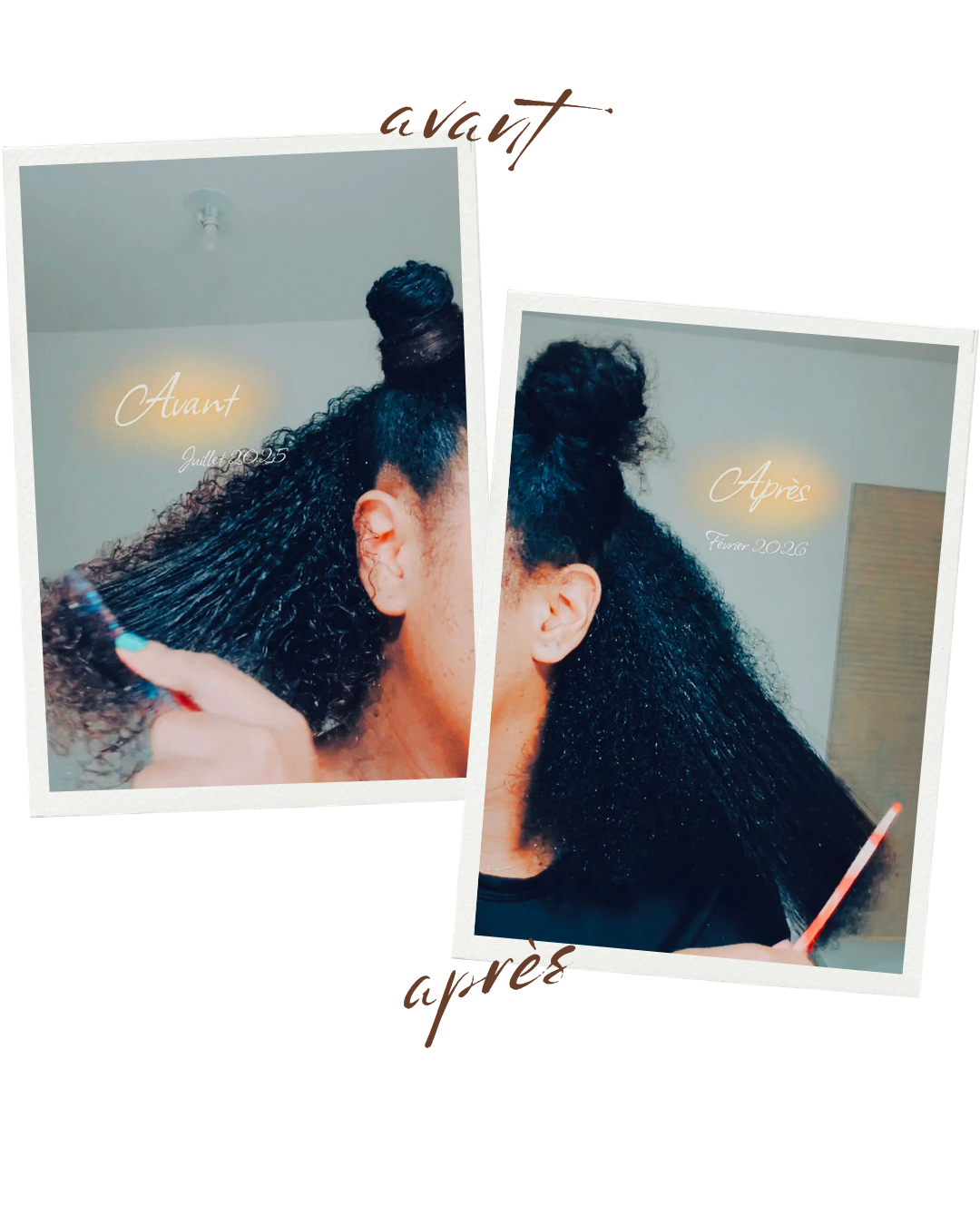 Stimulateur de Follicules à Lumière Rouge — Massage Cuir Chevelu pour Pousse & Rétention | Cheveux Crépus | Oëyya