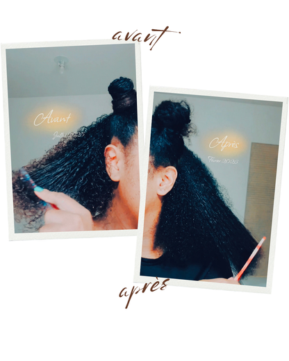 Stimulateur de Follicules à Lumière Rouge — Massage Cuir Chevelu pour Pousse & Rétention | Cheveux Crépus | Oëyya